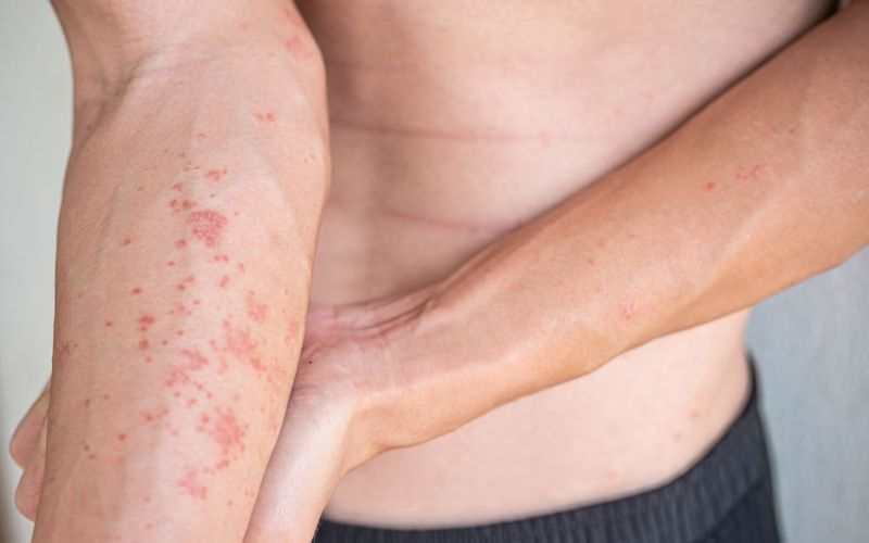 Ảnh hưởng đến sức khỏe